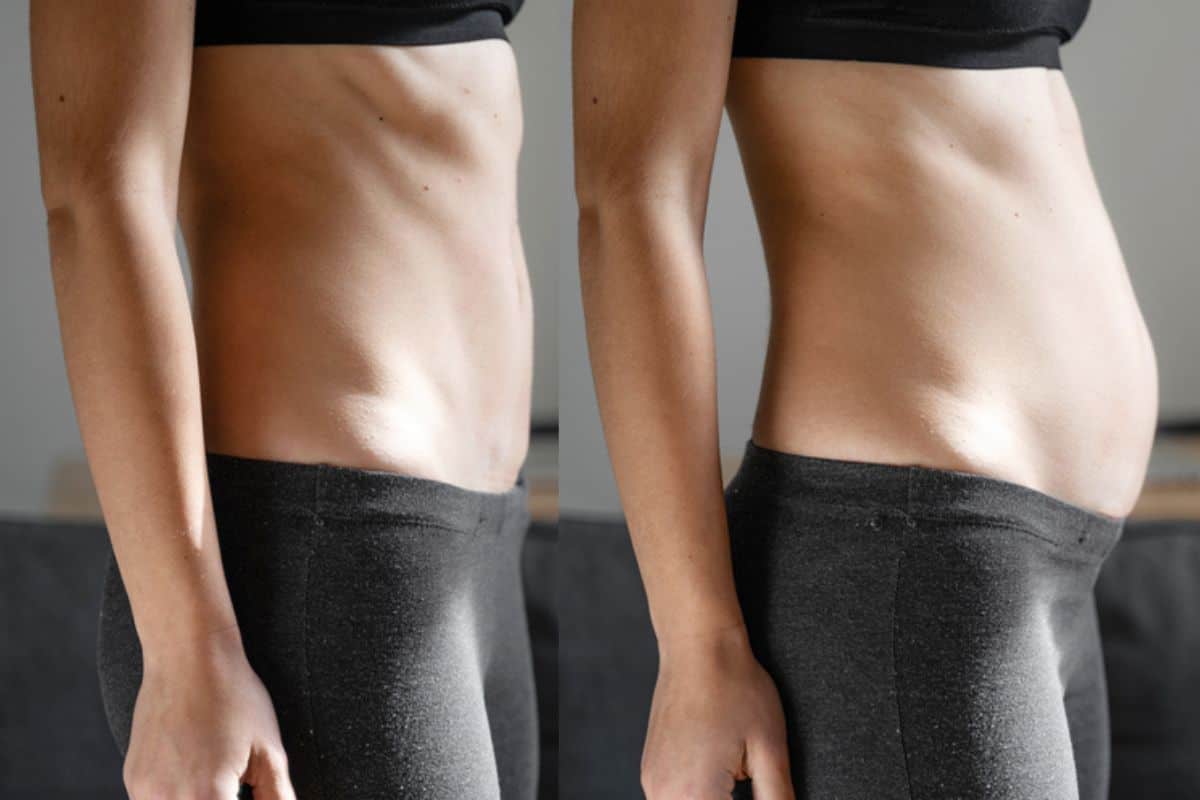 How long does diastasis recti take to improve Ascot?